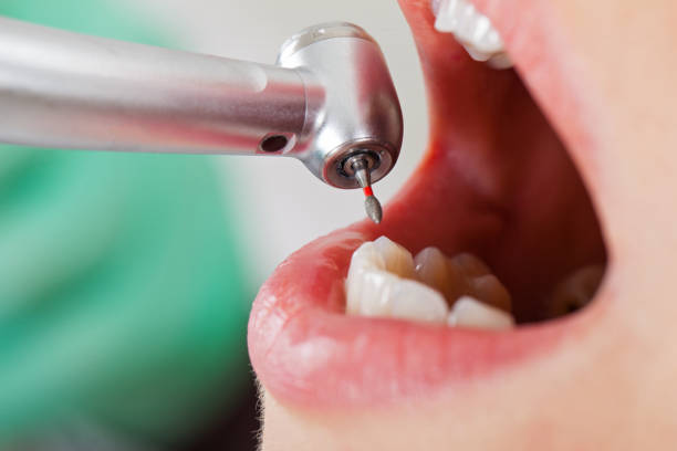 Best Tooth Infection Emergency Dentist  in Cressona, PA